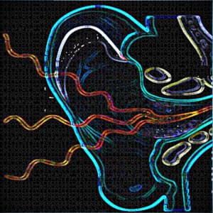 Tinnitus - Sleep Solution for Tinnitus