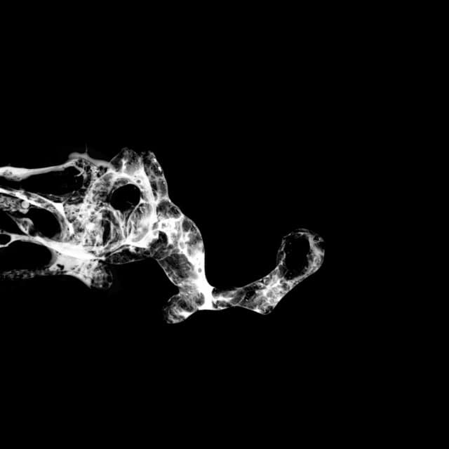 Tourette - SaffronKeira